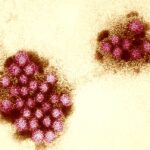 Norovirus vaccine hints at defusing explosive stomach bug in early trial