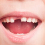 RFK Jr. wants to ban fluoride supplements based on nonsense