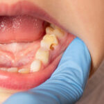 RFK Jr.‘s fluoride ban would ruin 25 million kids’ teeth, cost $9.8 billion